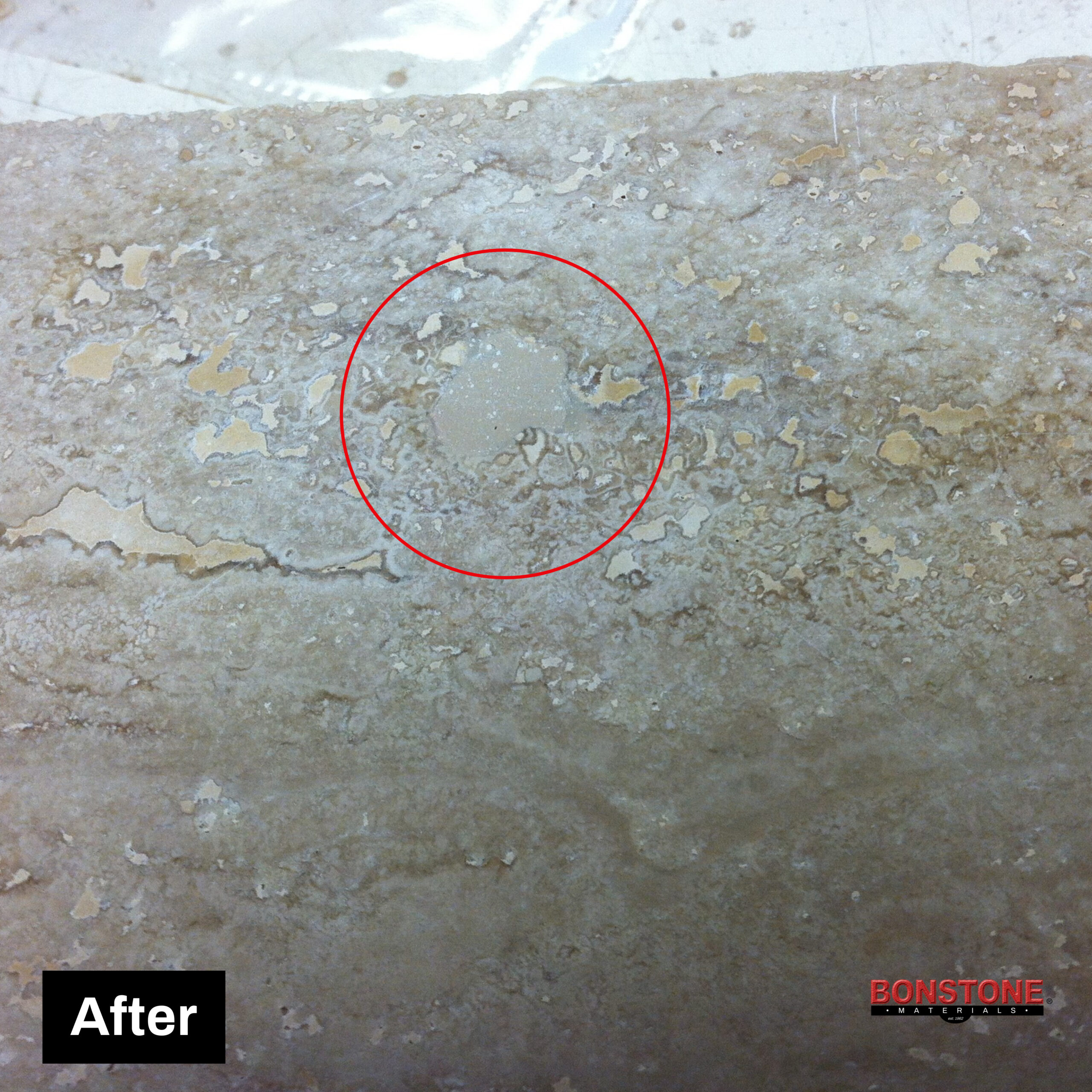 Bonstone Last Patch Gel Kit