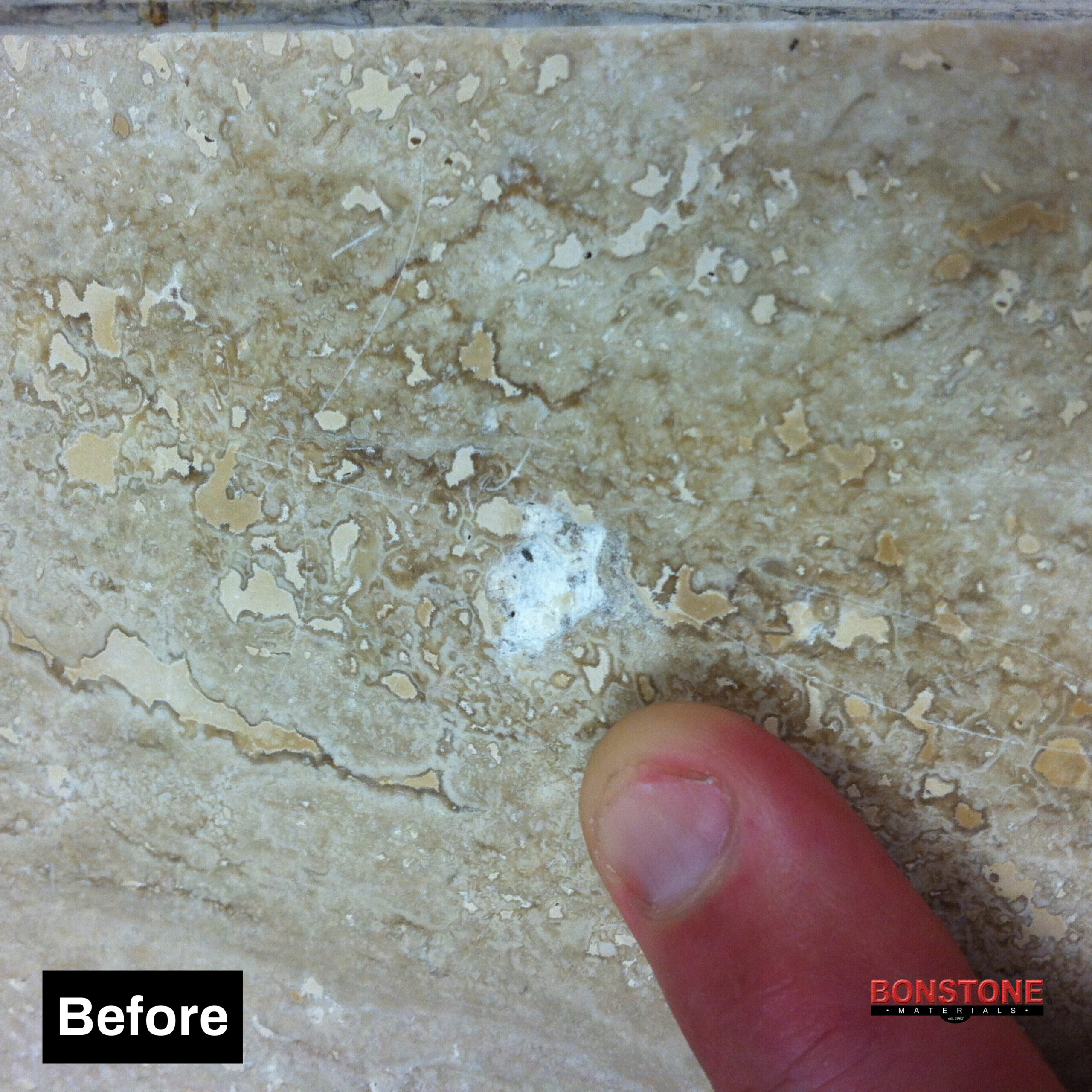 Bonstone Last Patch Gel Kit