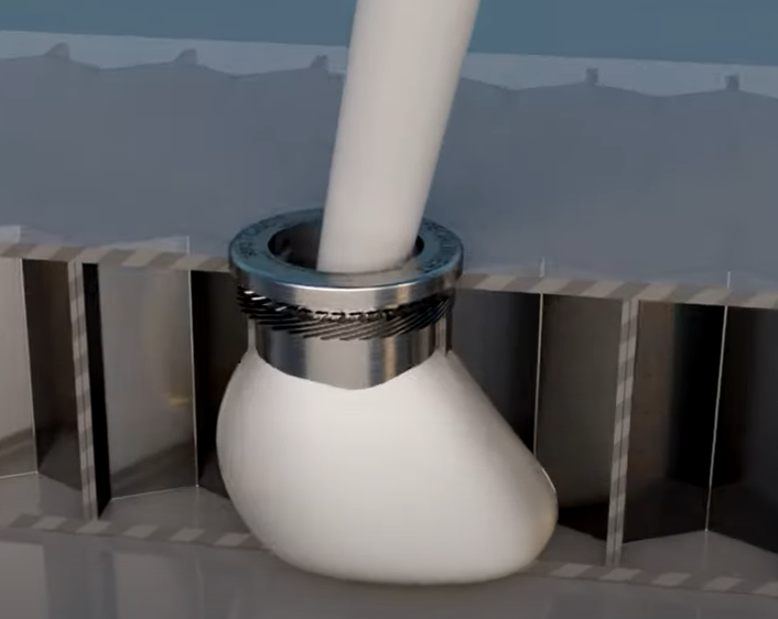 Adhesive Injection